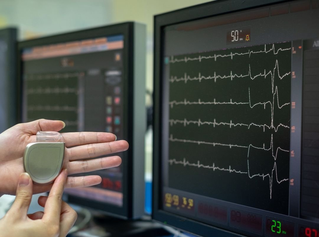 Love Cell: Jantung Elektronik Cilacap yang Tak Pernah Padam